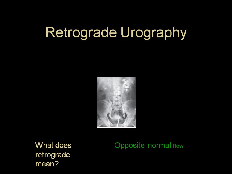 Retrograde Urography What does retrograde mean? Opposite normal flow